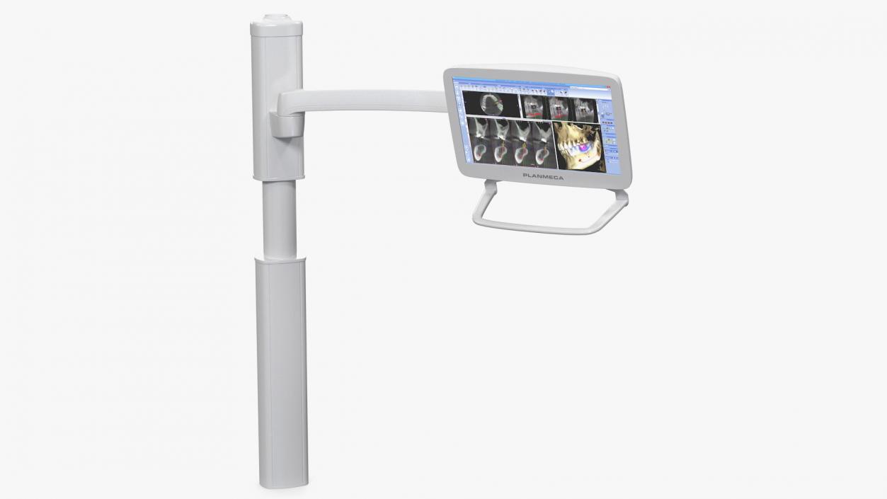 Planmeca Serenus Medical Display 3D