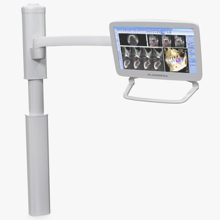 Planmeca Serenus Medical Display 3D