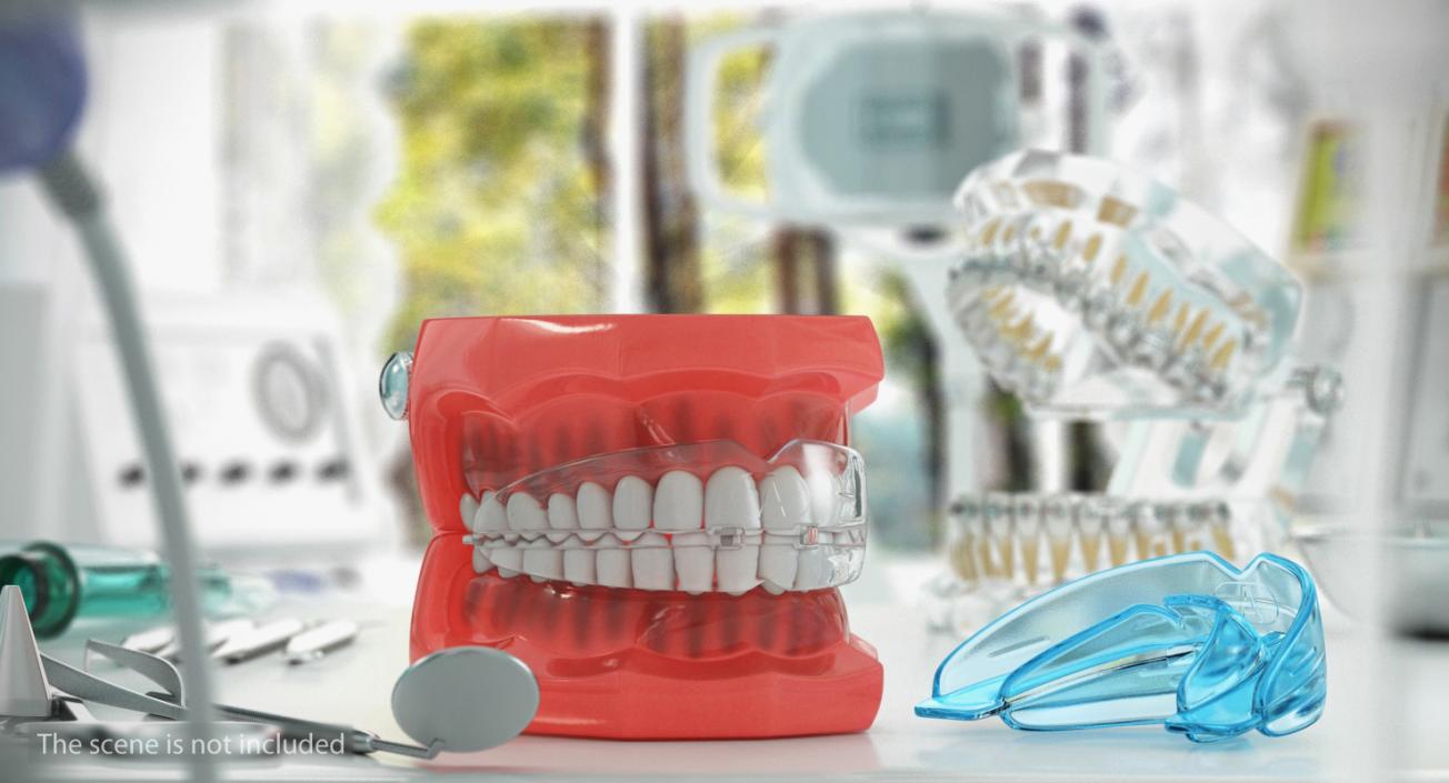 Braces Correction Retainers 3D