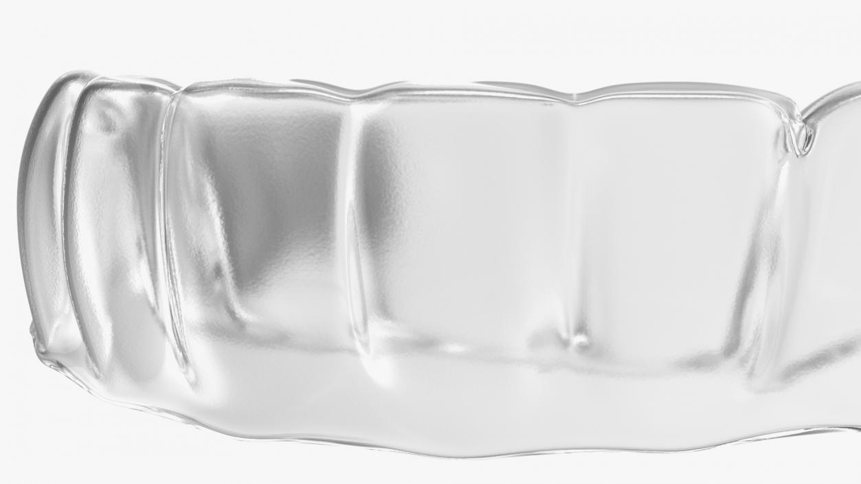 3D Teeth Replacement Retainer