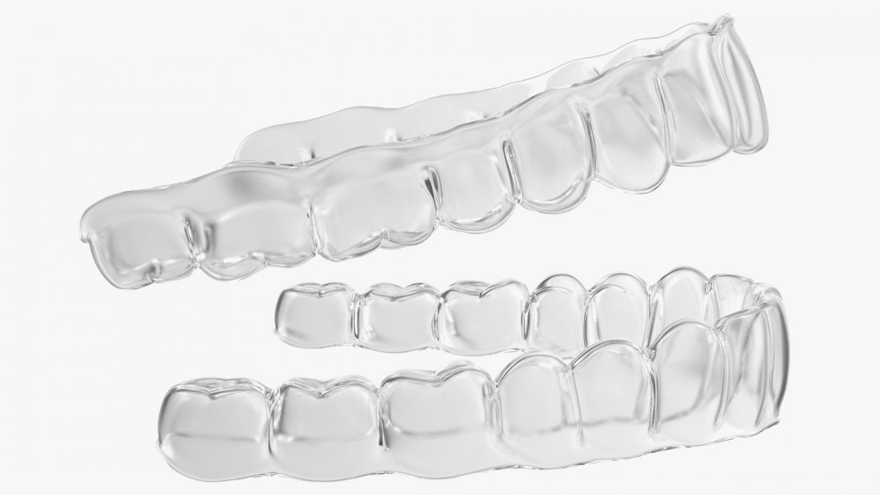 3D Teeth Replacement Retainer