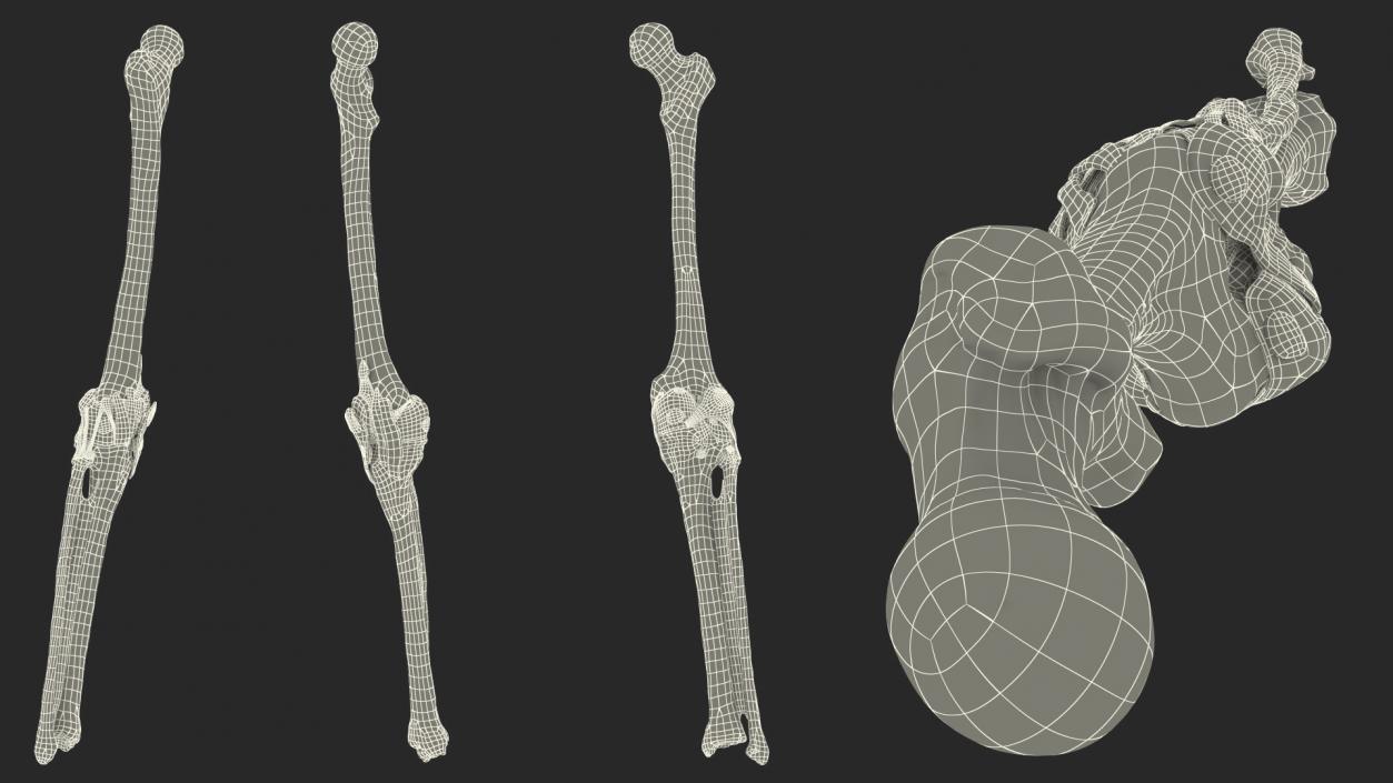 3D Human Knee Bones