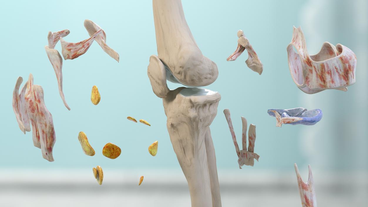 3D Human Knee Bones