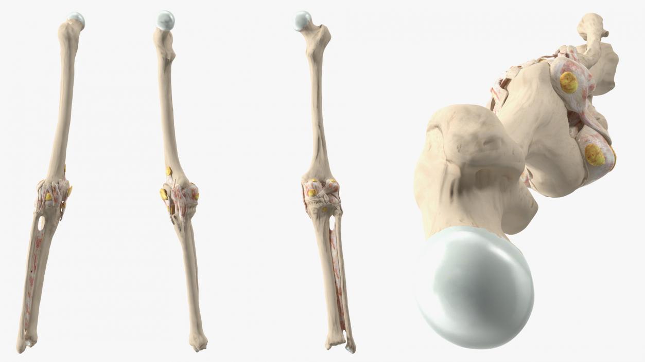 3D Human Knee Bones