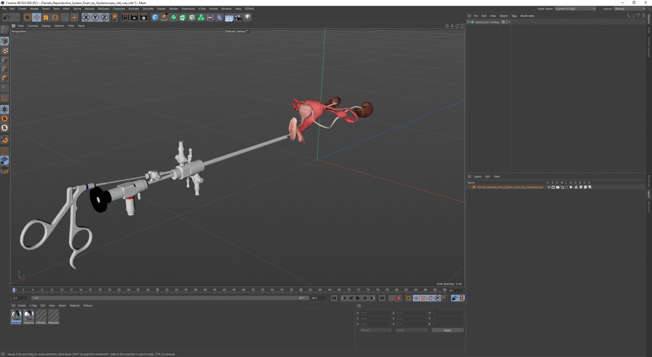 Female Reproductive System Exam by Hysteroscope 3D