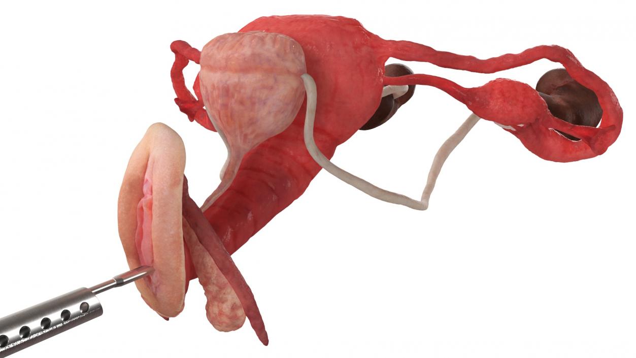 Female Reproductive System Exam by Hysteroscope 3D