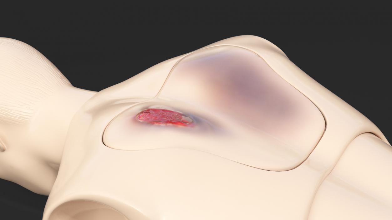 3D Injured Firstaid Mannequin Body