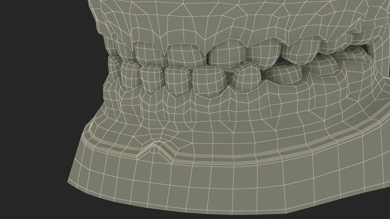 3D Typodont Teaching Studying Model with Removable Underbite Teeth model