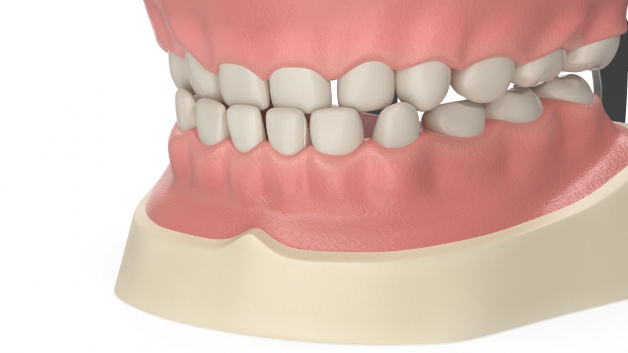 3D Typodont Teaching Studying Model with Removable Underbite Teeth model