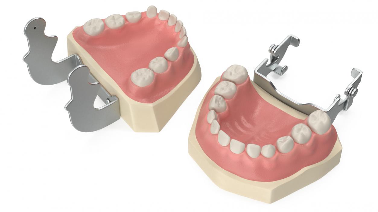 3D Typodont Teaching Studying Model with Removable Underbite Teeth model