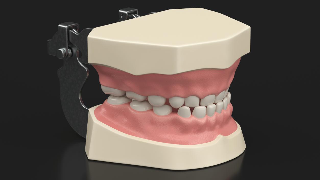 3D Typodont Teaching Studying Model with Removable Underbite Teeth model