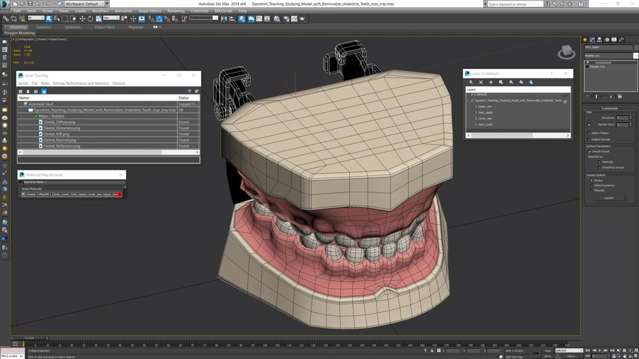 3D Typodont Teaching Studying Model with Removable Underbite Teeth model