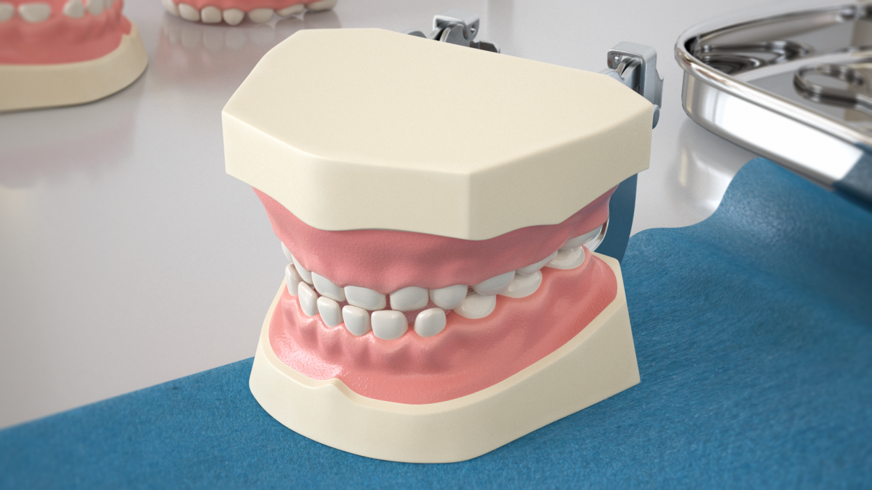 3D Typodont Teaching Studying Model with Removable Underbite Teeth model