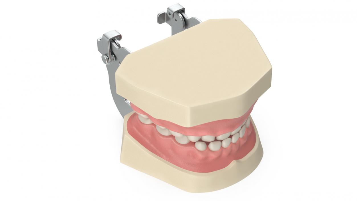 3D Typodont Teaching Studying Model with Removable Underbite Teeth model