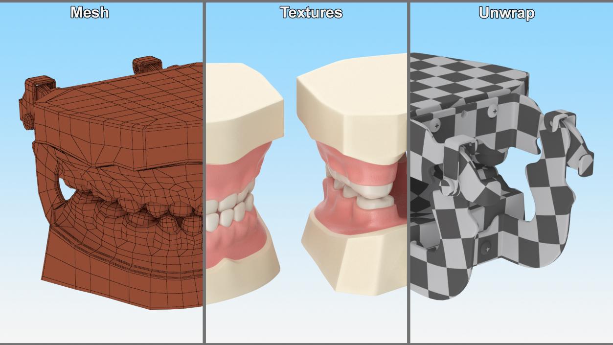 3D Typodont Teaching Studying Model with Removable Underbite Teeth model