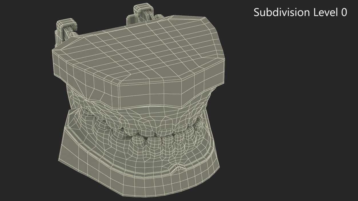 3D Typodont Teaching Studying Model with Removable Underbite Teeth model