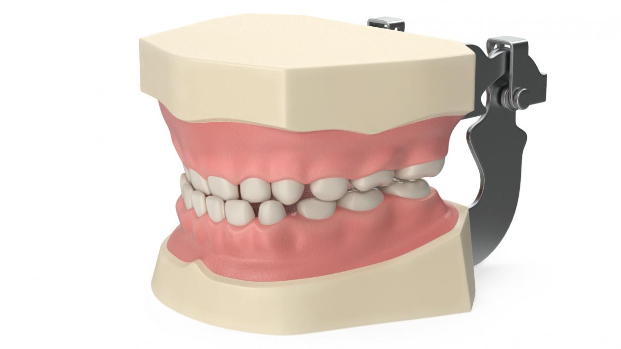 3D Typodont Teaching Studying Model with Removable Underbite Teeth model