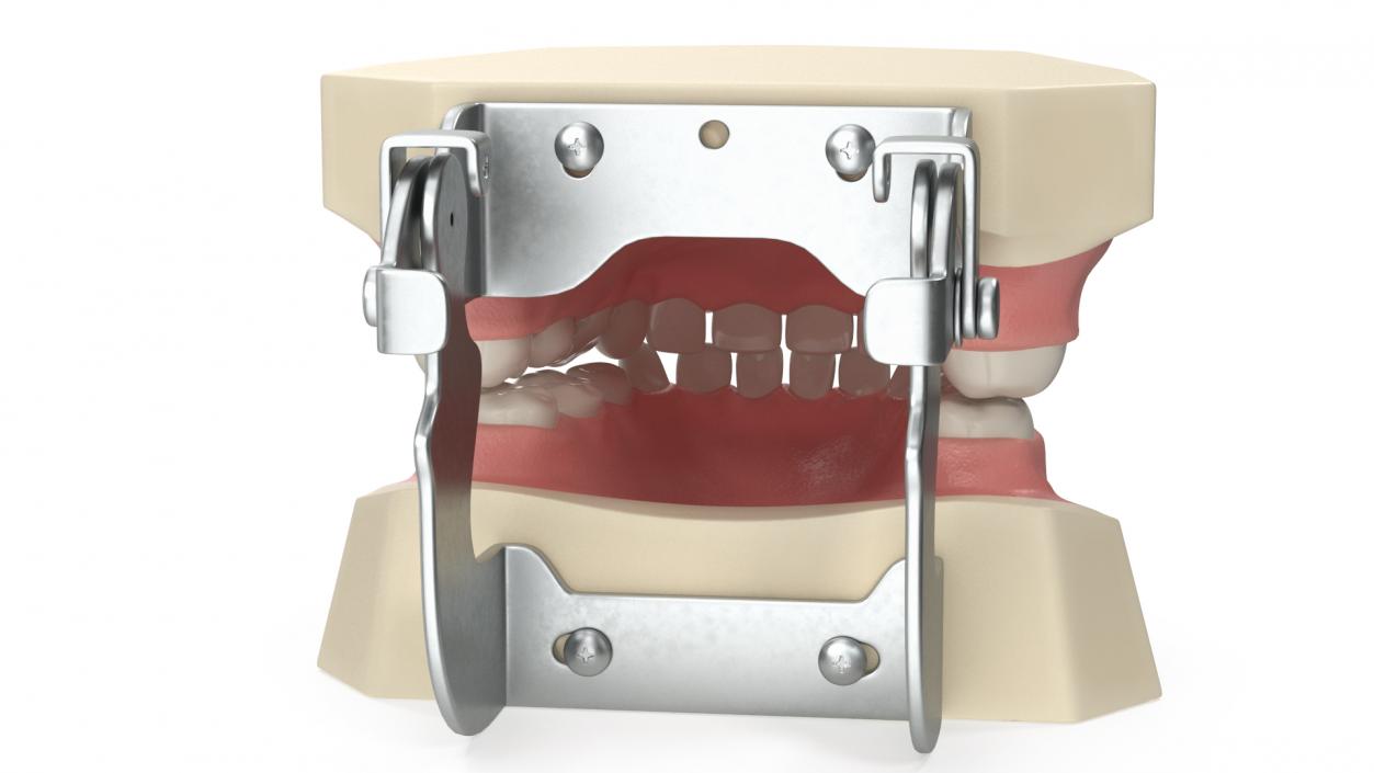 3D Typodont Teaching Studying Model with Removable Underbite Teeth model