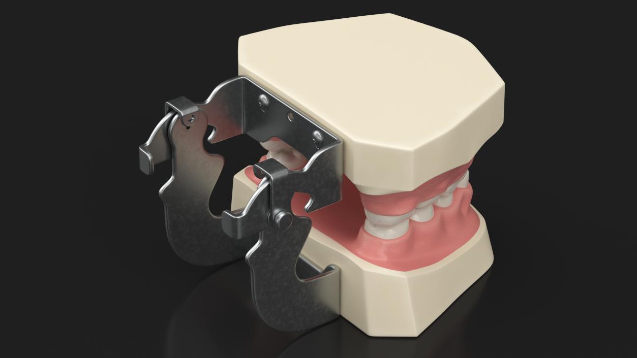 3D Typodont Teaching Studying Model with Removable Underbite Teeth model