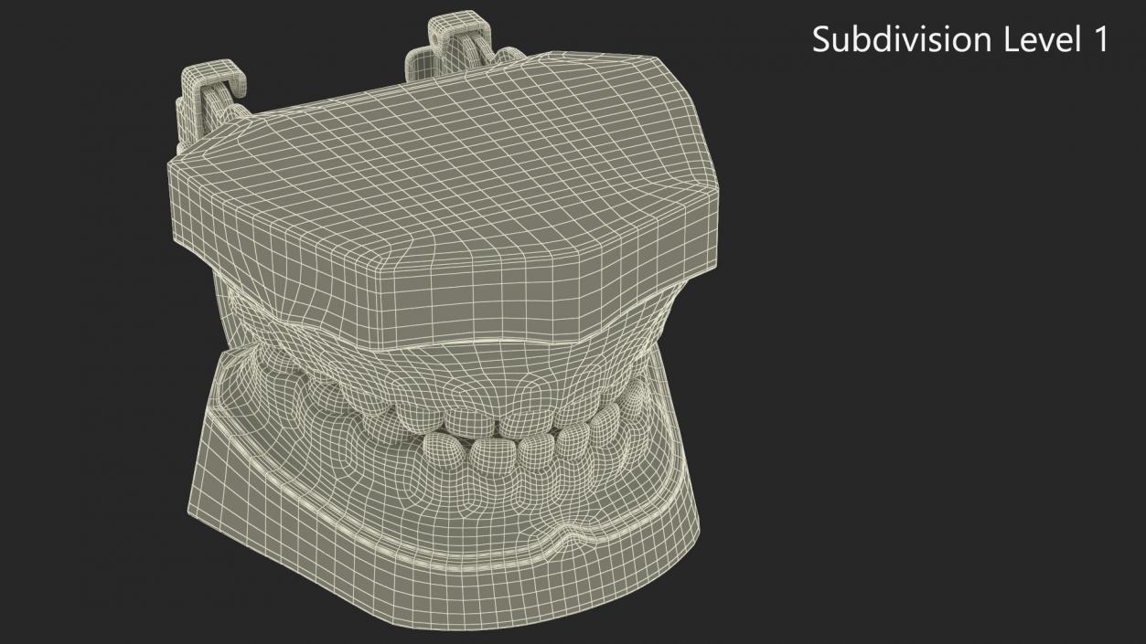 3D Typodont Teaching Studying Model with Removable Underbite Teeth model