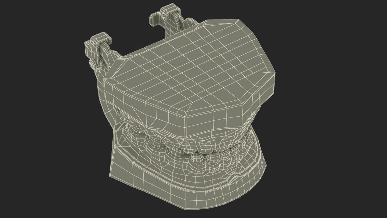 3D Typodont Teaching Studying Model with Removable Underbite Teeth model