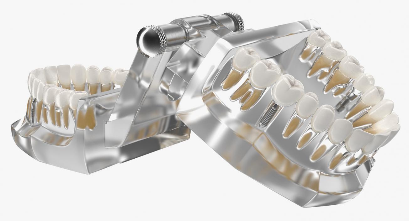 3D Transparent Dental Typodont With Dental Implants model