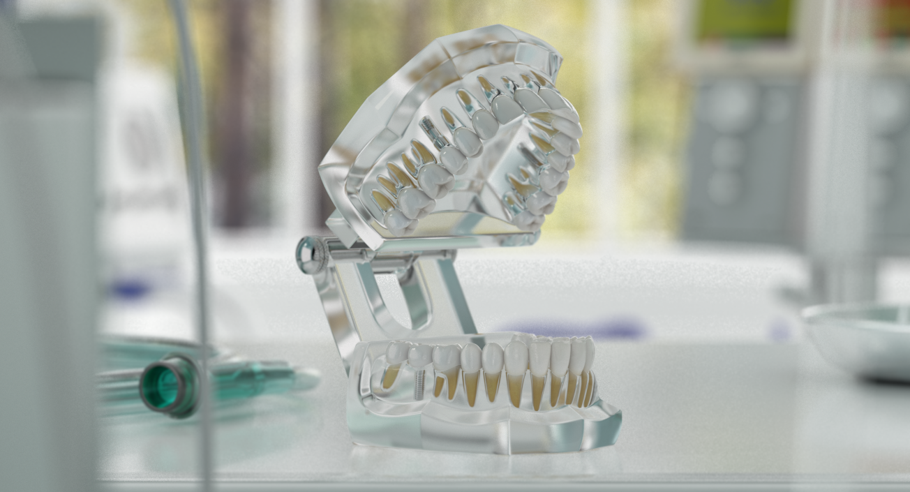 3D Transparent Dental Typodont With Dental Implants model