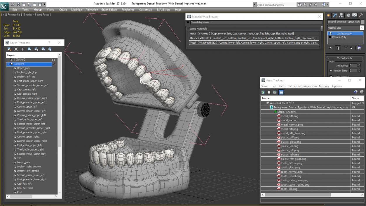 3D Transparent Dental Typodont With Dental Implants model