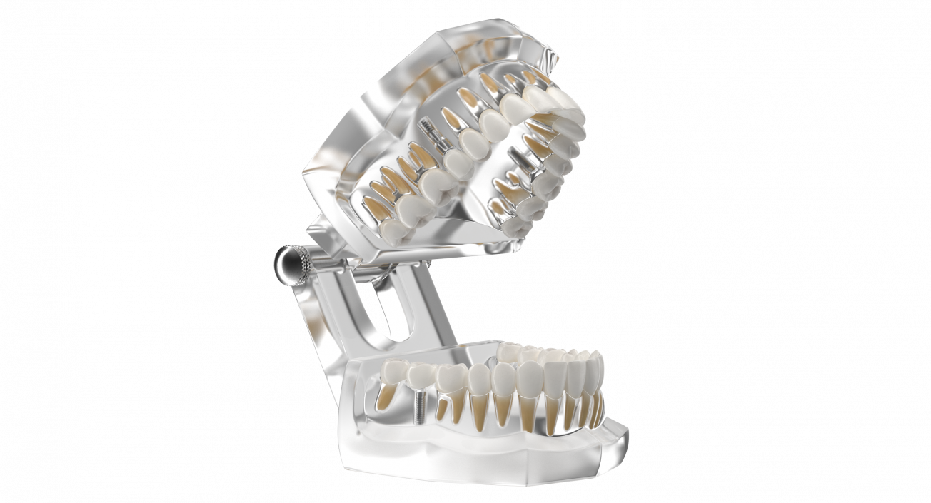 3D Transparent Dental Typodont With Dental Implants model