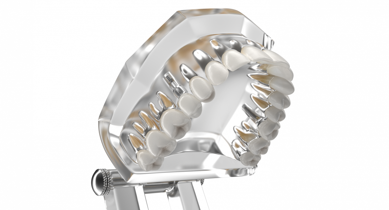 3D Transparent Dental Typodont With Dental Implants model