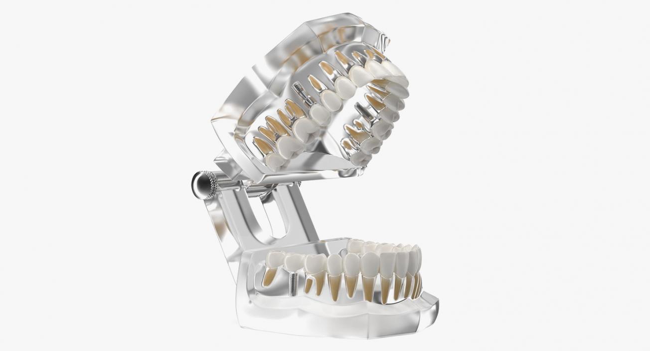 3D Transparent Dental Typodont With Dental Implants model