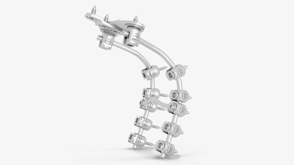 3D model Posterior Cervical Spine Fixation System