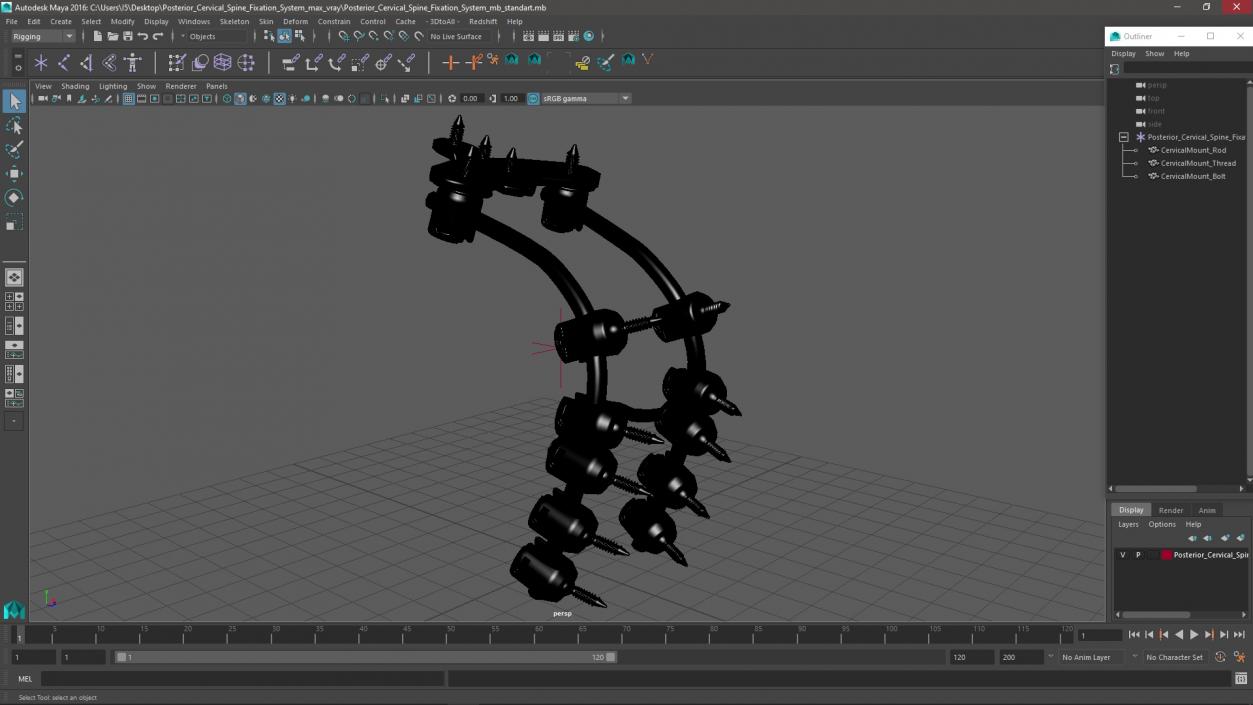 3D model Posterior Cervical Spine Fixation System