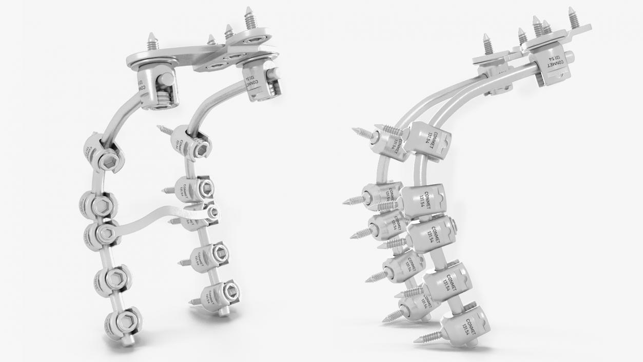 3D model Posterior Cervical Spine Fixation System