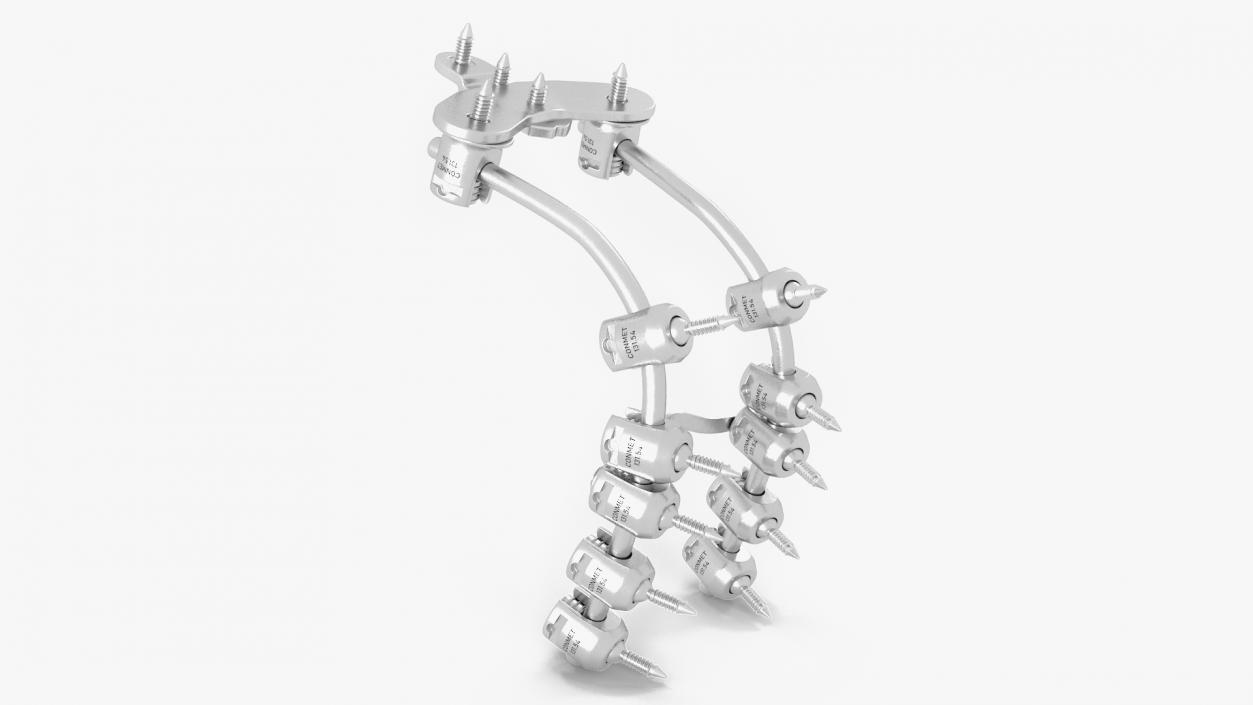 3D model Posterior Cervical Spine Fixation System