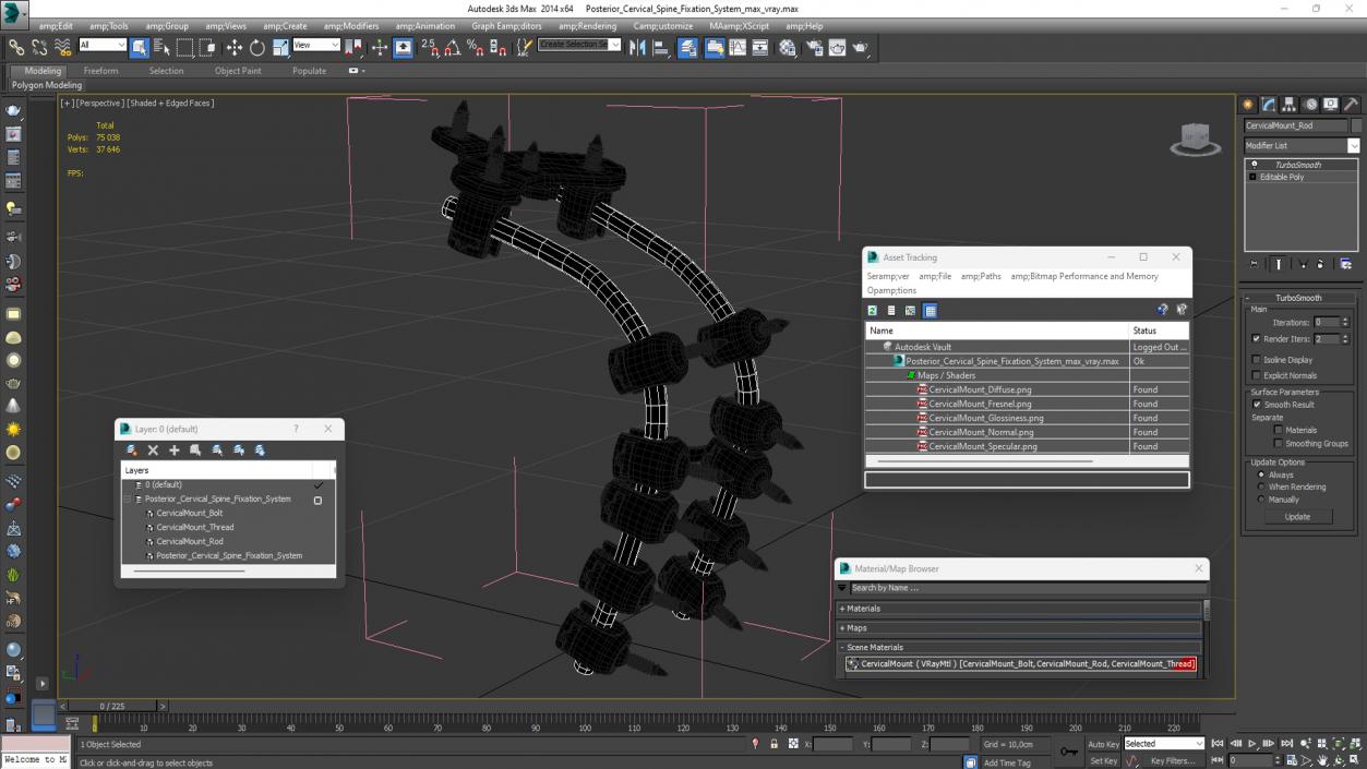 3D model Posterior Cervical Spine Fixation System