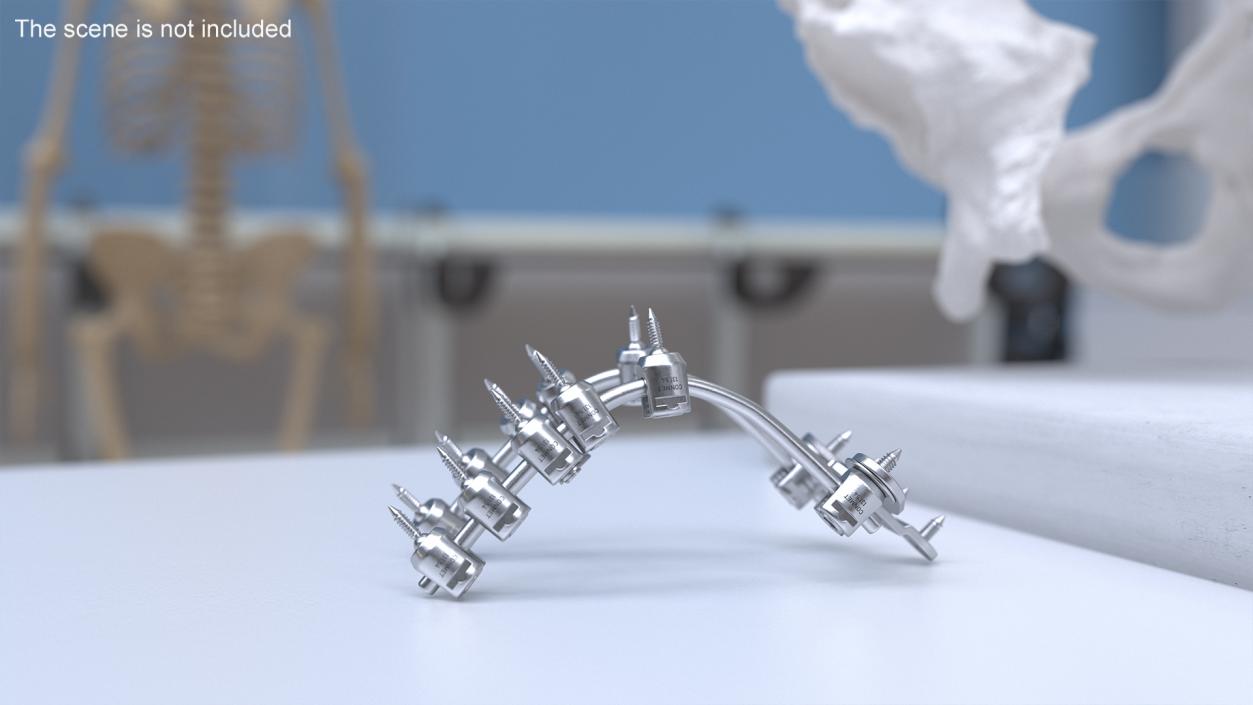 3D model Posterior Cervical Spine Fixation System