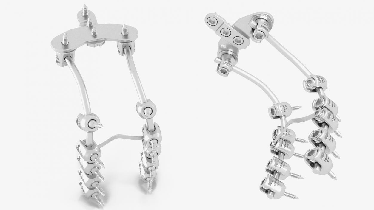 3D model Posterior Cervical Spine Fixation System