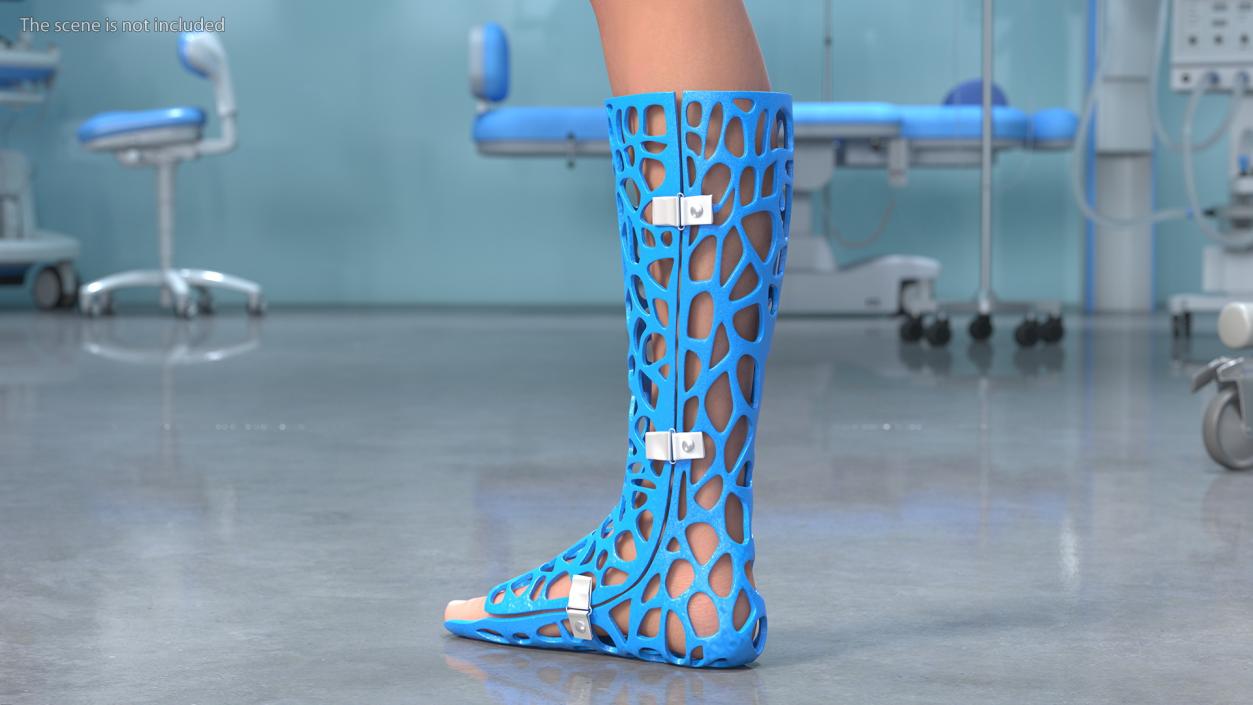 3D -Printed Orthopedic Cast On Leg