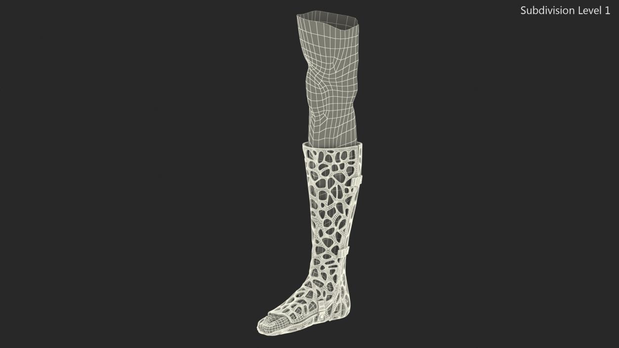 3D -Printed Orthopedic Cast On Leg