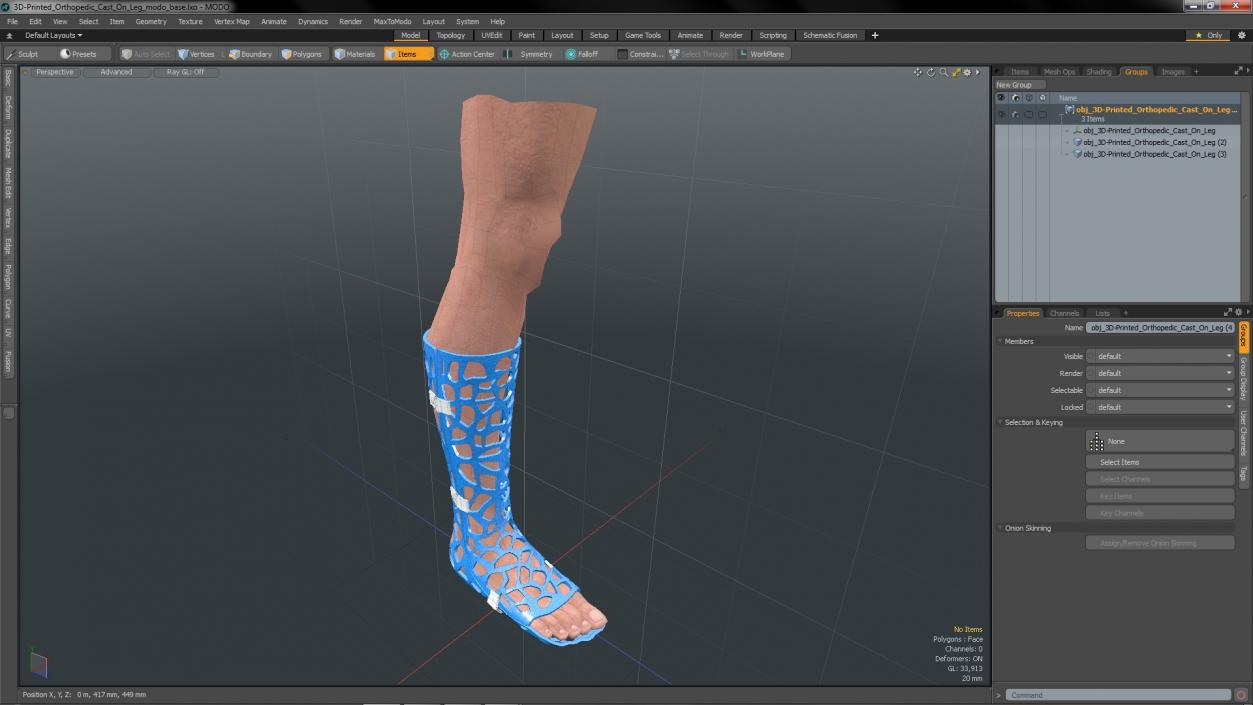 3D -Printed Orthopedic Cast On Leg