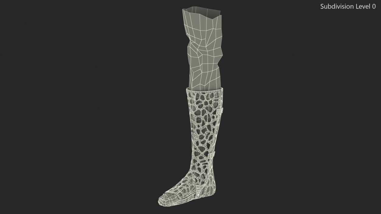 3D -Printed Orthopedic Cast On Leg