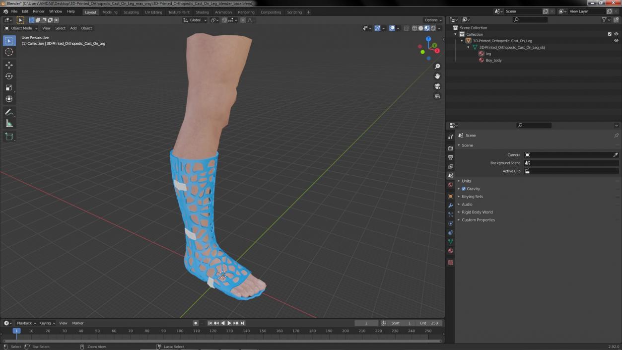 3D -Printed Orthopedic Cast On Leg