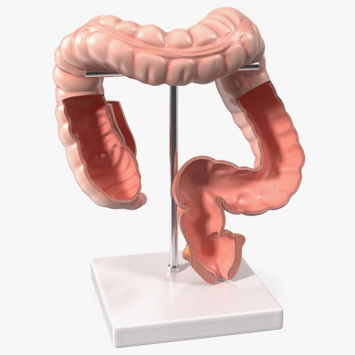 Intestine Medical 3D