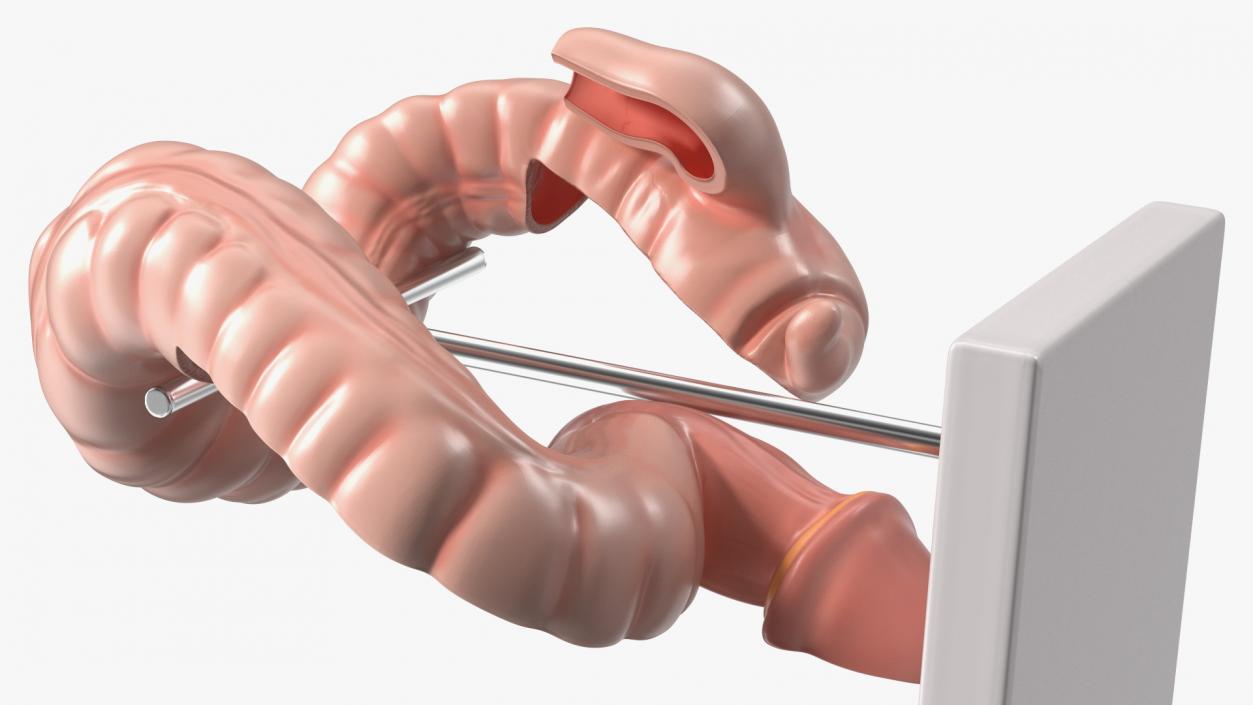 Intestine Medical 3D