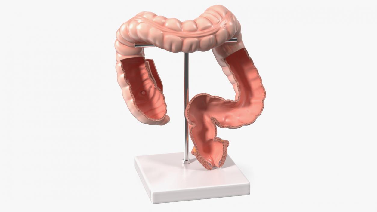 Intestine Medical 3D