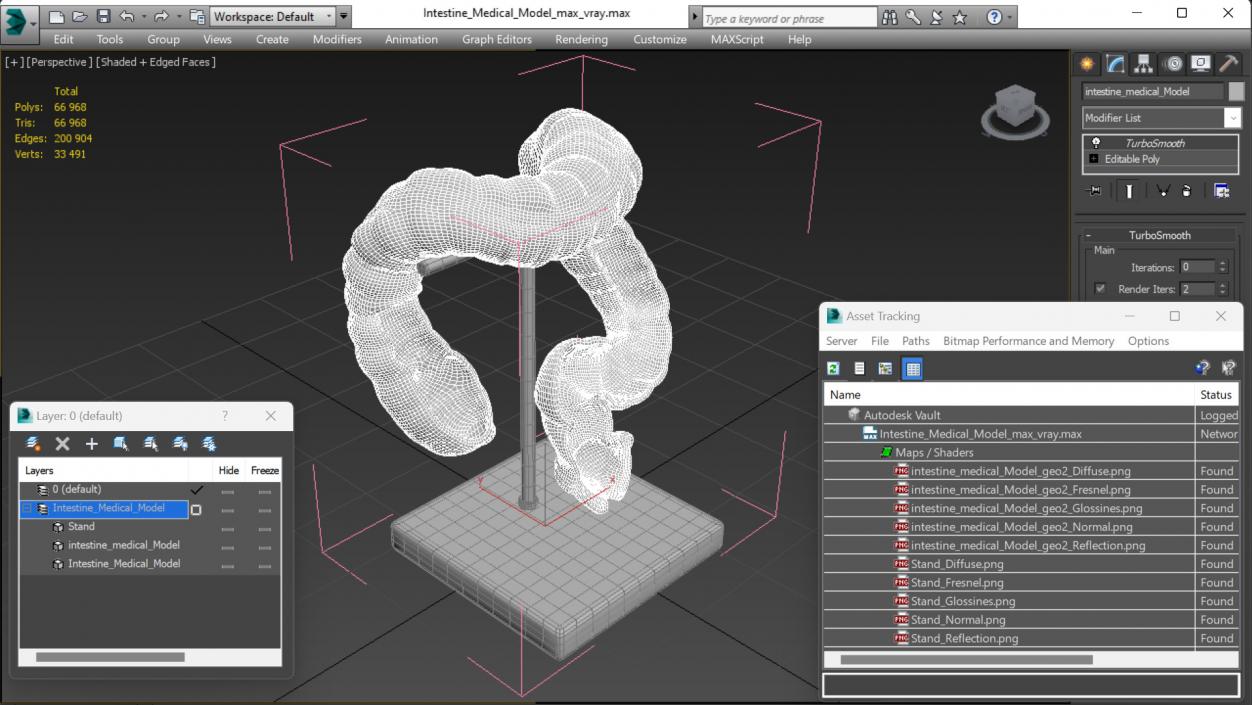 Intestine Medical 3D