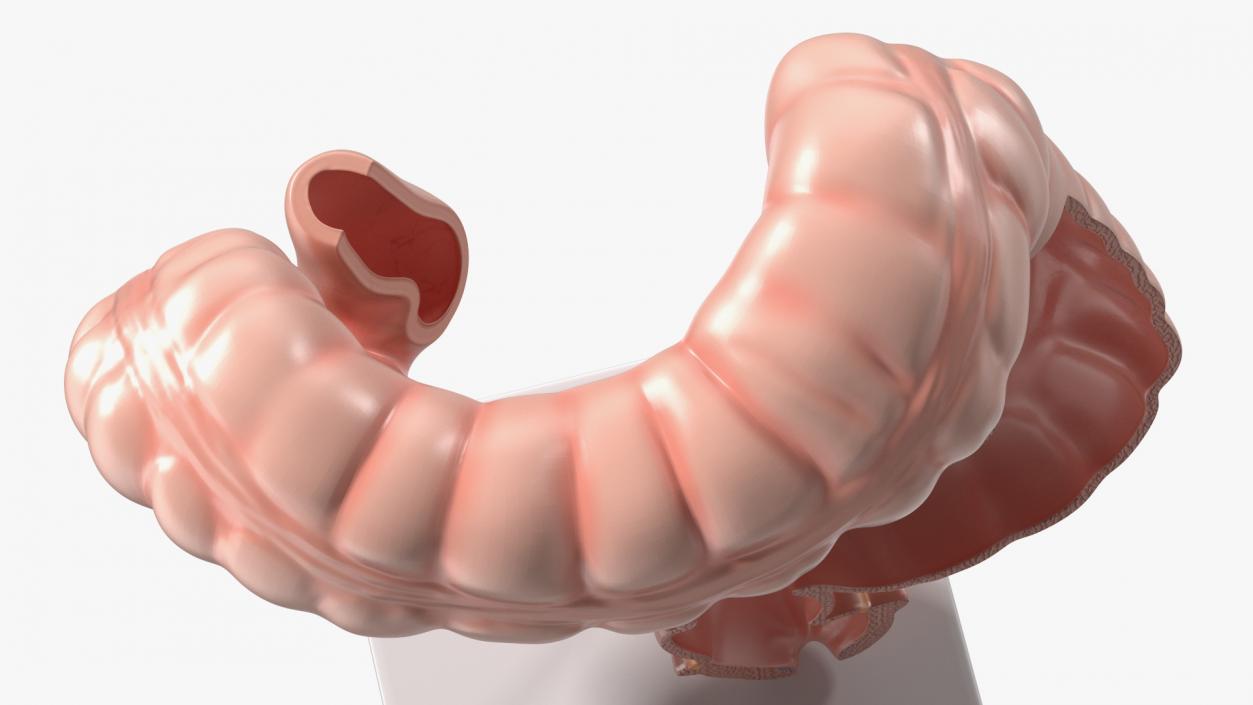 Intestine Medical 3D