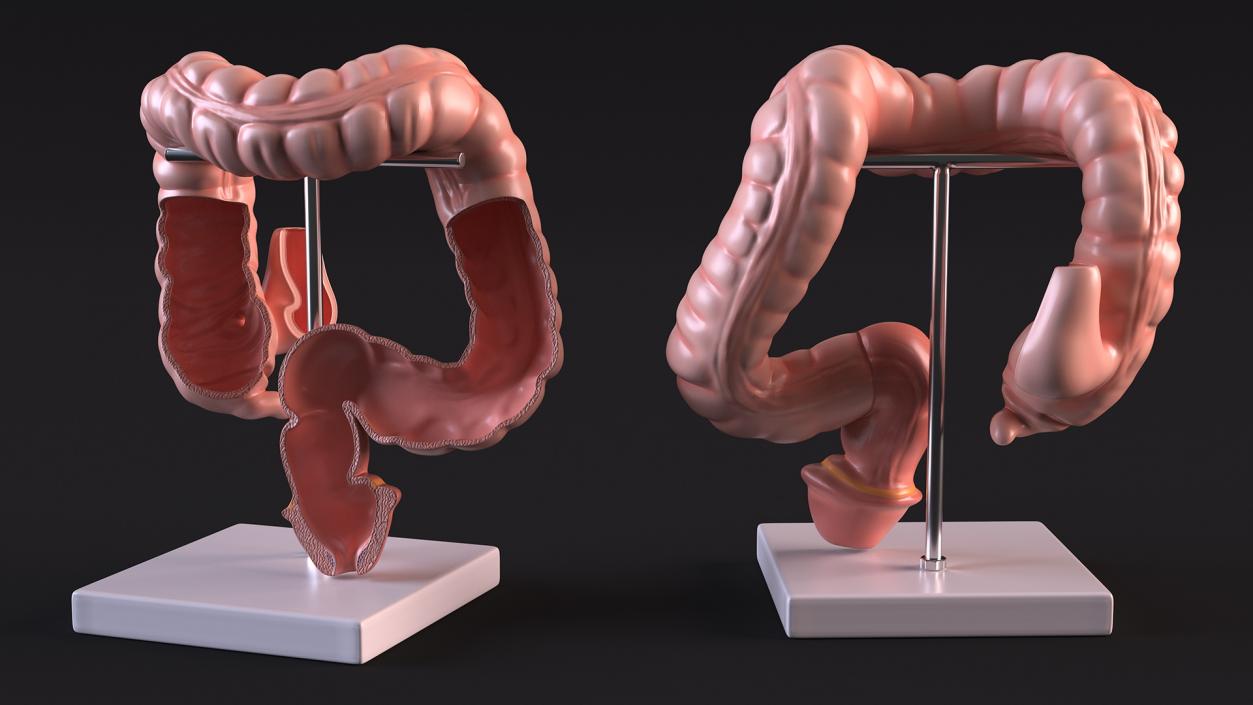 Intestine Medical 3D