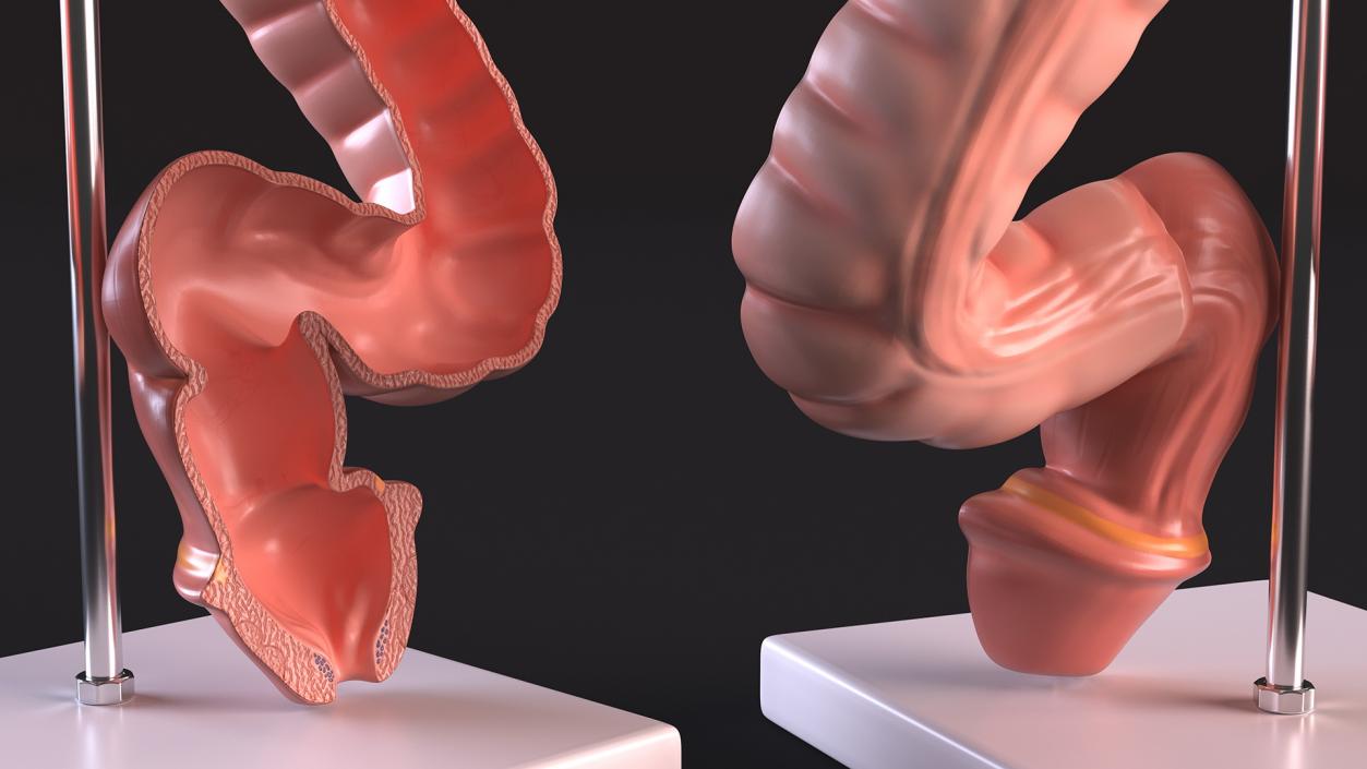 Intestine Medical 3D